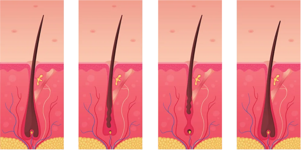 A follicle at each stage of the hair growth cycle, from growth to rest and back to growth