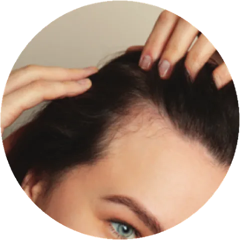 Woman checking her scalp at the hairline