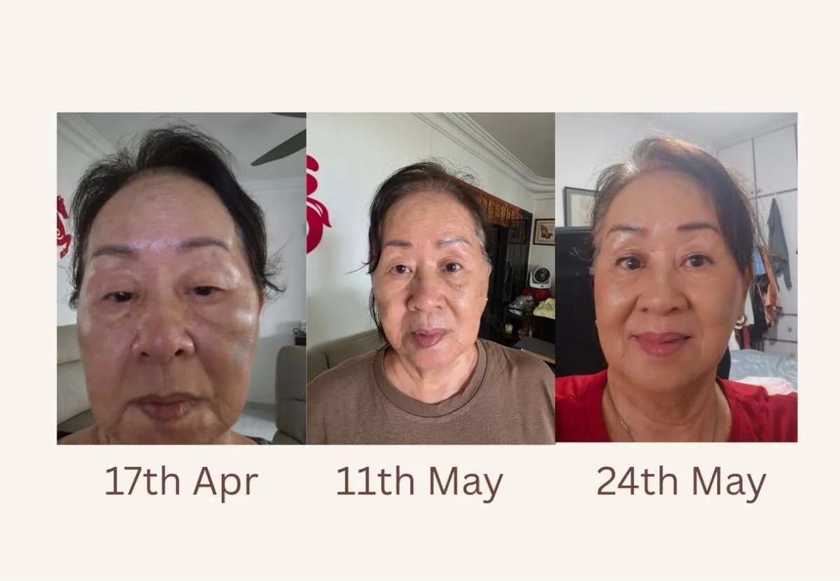 Emelyn’s mum: Three photos taken at home on 17 April, 11 May and 24 May 2026.