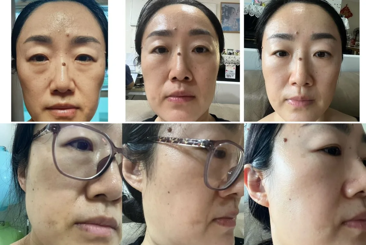 Yuan Yuan: Before and after, from the front and the side.